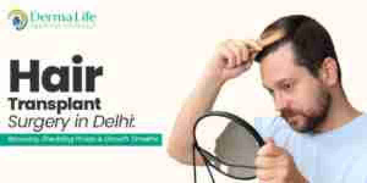 Delhi, Noida & Gurgaon Hair Transplant: Cost, Top Doctor & Latest Boosted FUE Hair Transplant Guide